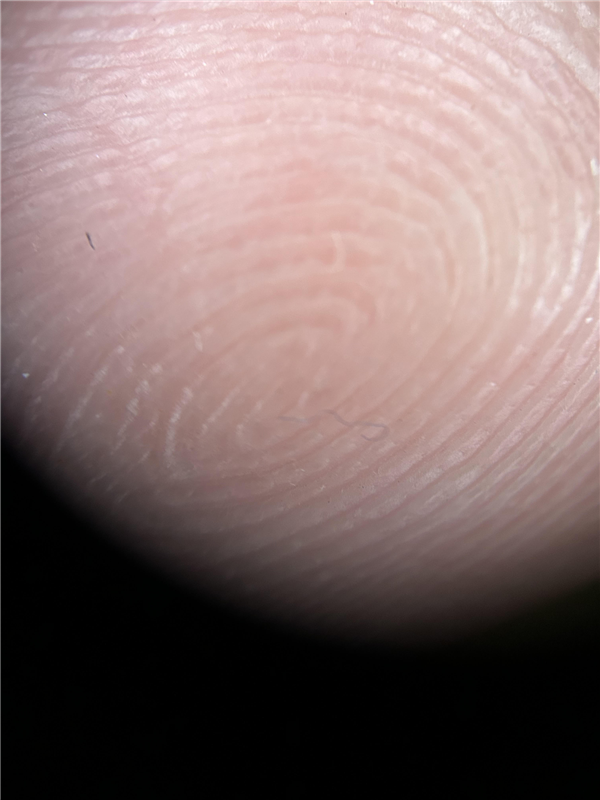 What is it?